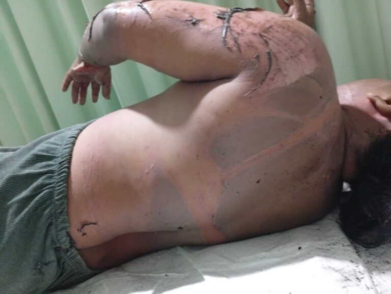 Warga Todanan Terbakar